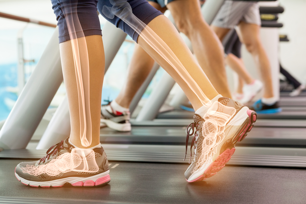 bones highlighted on person walking on a treadmill